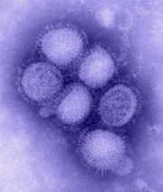 Electron microscope image of the reassorted H1N1 influenza virus photographed at the CDC Influenza Laboratory. The viruses are 80–120 nanometres in diameter.<ref>Template:Cite web</ref>